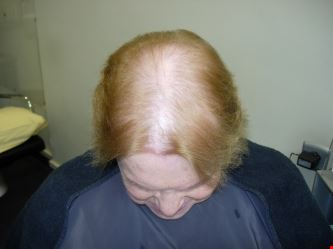 Synthetisch haar - synthetische pruiken